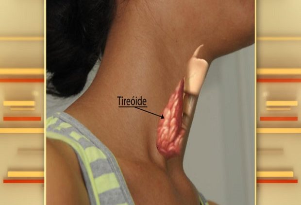 Saiba tudo sobre a tiroide